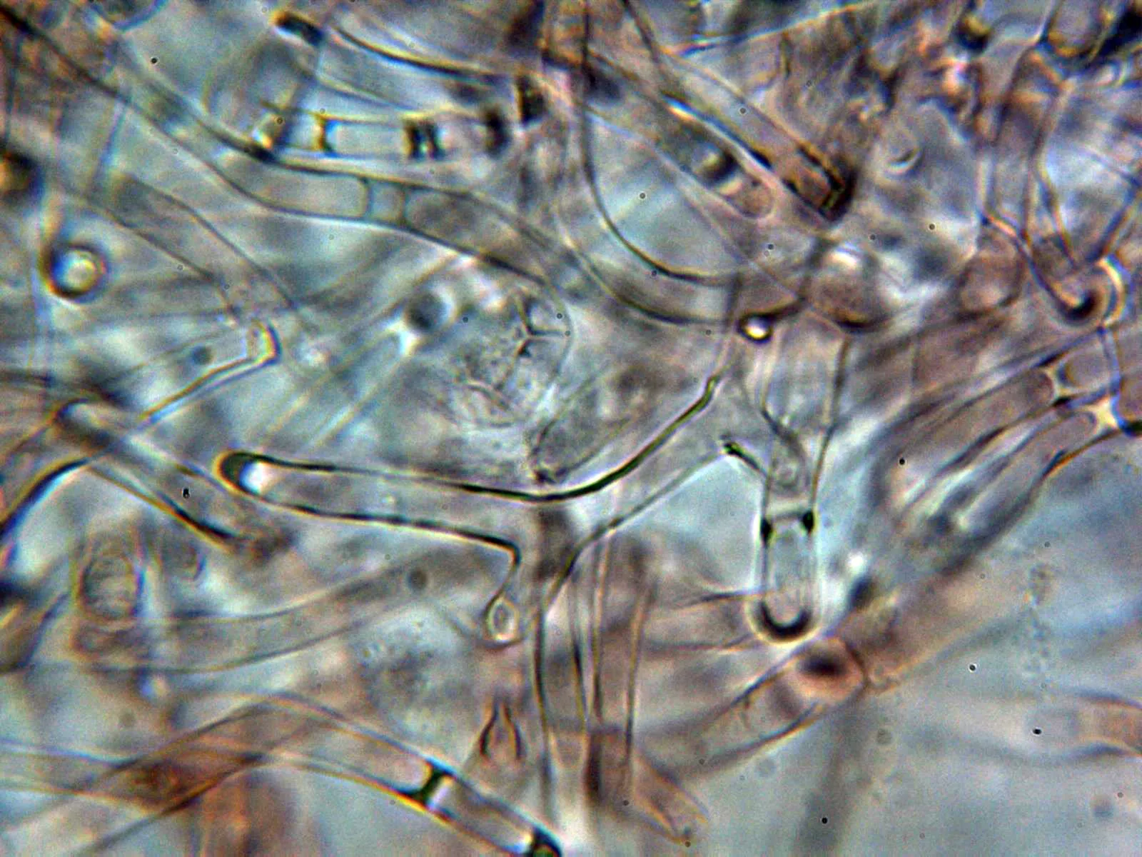 Microscopía de Melanoleuca microcephala - 10 - Suprapellis 1